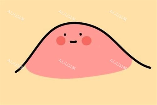 眼角脂肪粒示意图