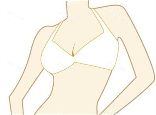 挺拔胸部形态卡通示意图 挺拔胸部形态卡通示意图