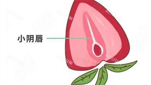 小阴唇整形 小阴唇整形