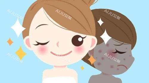 光子嫩肤后的成效 光子嫩肤后的成效