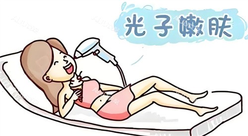光子嫩肤图 光子嫩肤图