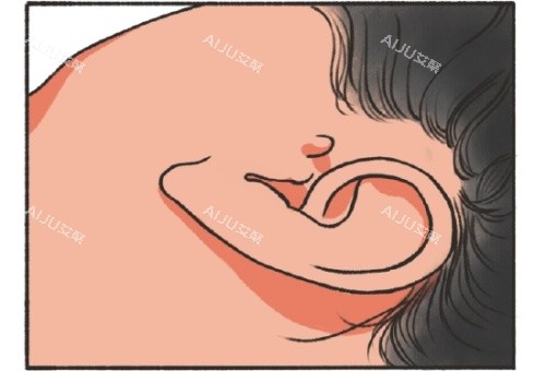 副耳形态示意图 副耳形态示意图