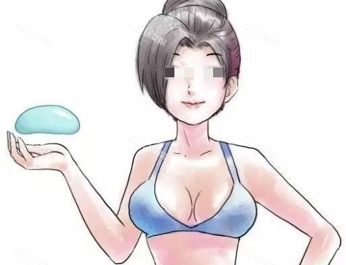 圆形假体隆胸示意图_副本