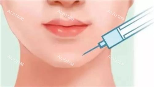 娜楚玻尿酸丰下巴的示意图