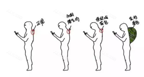 富贵包的形状