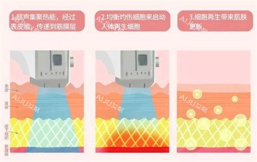 超声波原理 超声波原理