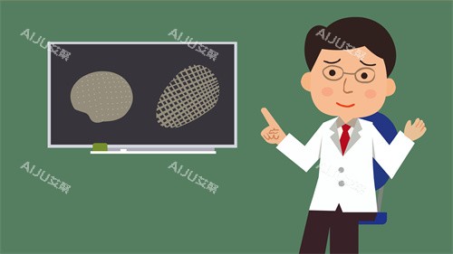 颅骨修复材料的对比动画图