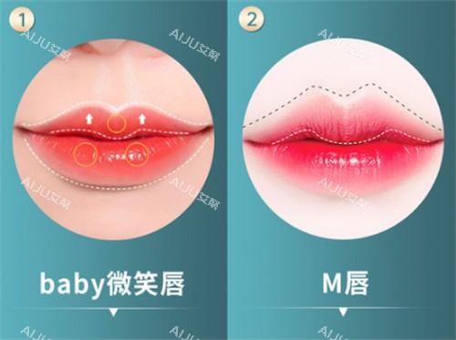 不同唇形对比图