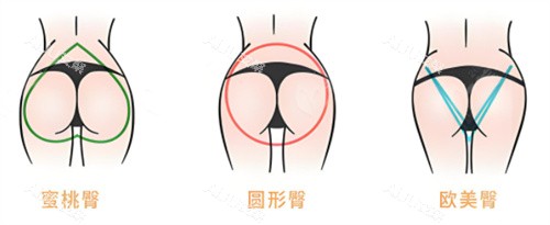 多种臀部形态素材图片