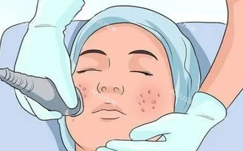 面部美容卡通示意图 面部美容卡通示意图