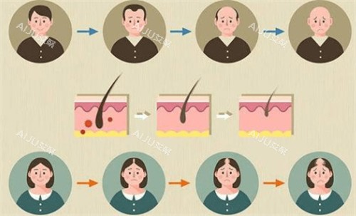 黑米3d纹发前后对比
