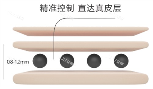 黑米3d纹发过程解析