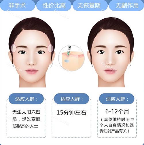 玻尿酸注射填充适合人群与原理动画图