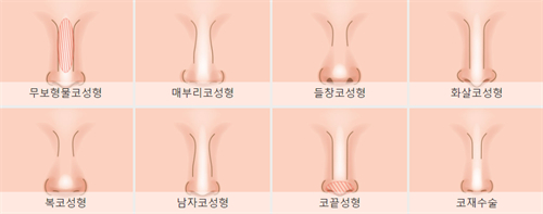 不同需要进行鼻整形的鼻子 不同需要进行鼻整形的鼻子