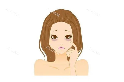 黑眼圈卡通示意图