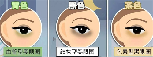 不同的黑眼圈类型