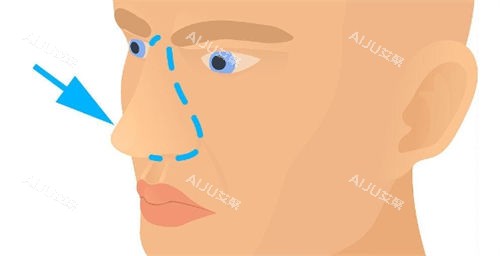 鼻部画线展示图