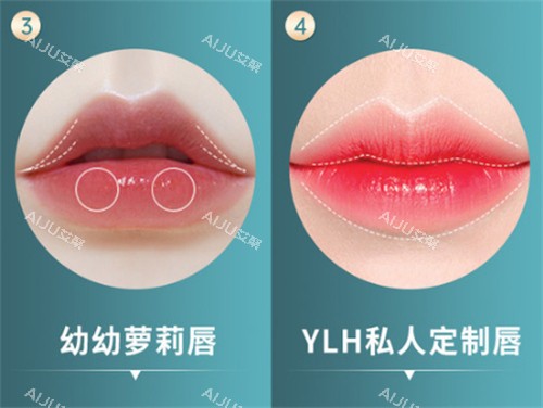 不同唇型展示