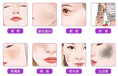 不同的皮肤斑点问题 不同的皮肤斑点问题