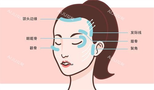 面部提升区域 面部提升区域