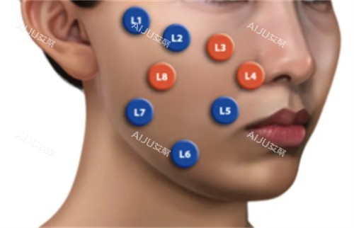 乔雅登不同点位注射方法 乔雅登不同点位注射方法