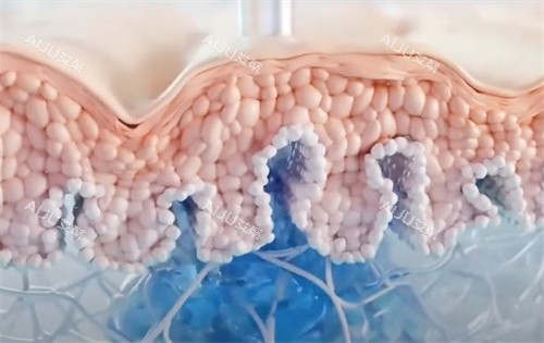 乔雅登HarmonyCA注射 乔雅登HarmonyCA注射