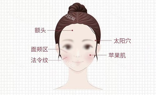 面部注射区 面部注射区