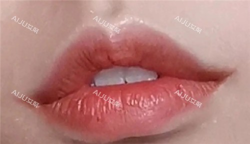 微笑唇照片