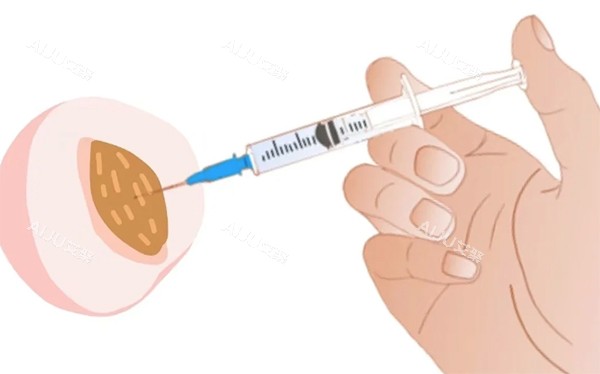私密注射紧缩针照片