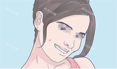 酒窝示意图