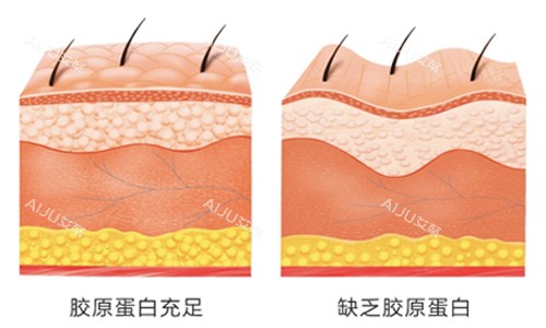胶原蛋白