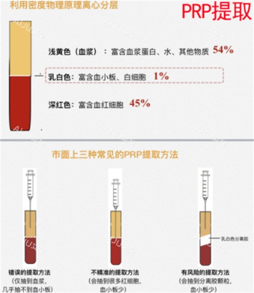 丽芙莎高潮针的原理介绍