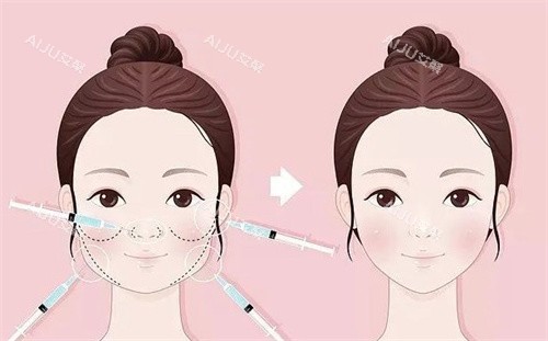 姬付康医生馒化脸修复前后