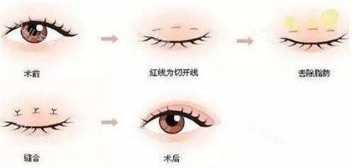 唐山做双眼皮哪家医院比较靠谱？从医生资质到术后反馈，金荣、煤医尚美、苏亚美联臣实力大PK！