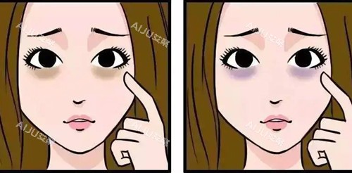 有无黑眼圈卡通示意图 有无黑眼圈卡通示意图