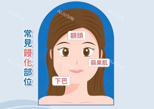 馒化脸常见部位