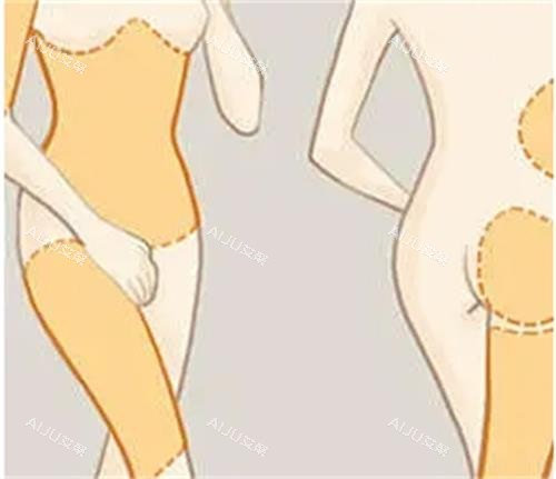 吸脂手术前后对比图