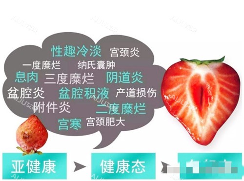 菲蜜丽解问题图示