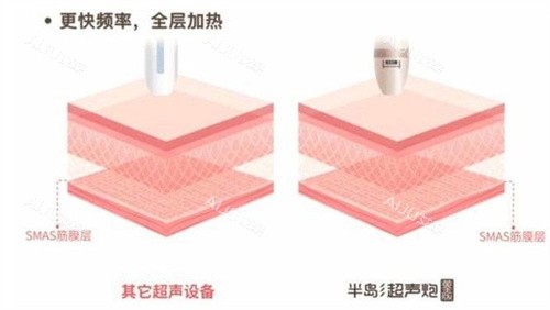半岛逆时针