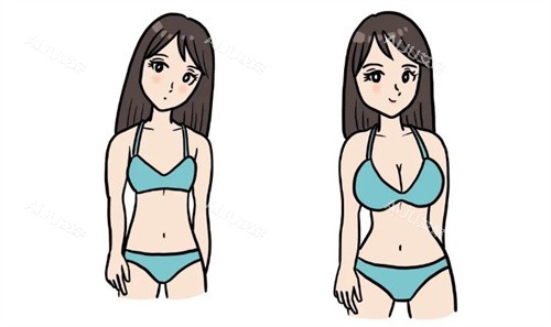 广州蒋思军丰胸怎么样？几乎无差评，内窥镜丰胸技术靠谱|创伤小|形态自然