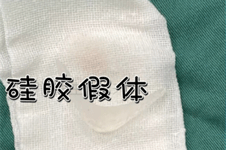 假体和玻尿酸隆下巴哪个自然？从触感、修复期到维持时间详细对比，一文教你避开不自然网红脸