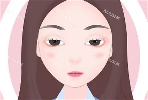 上眼睑下垂1