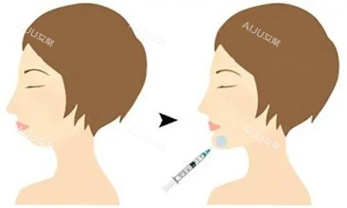 注射垫下巴前后的区别