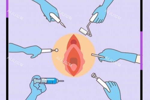 南京赵利平私密整形卡通图