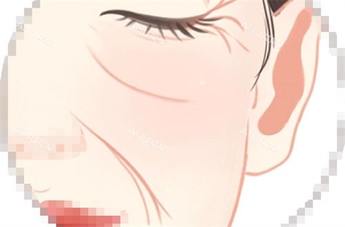 面部面中老化细纹动画展示图.jpg
