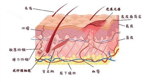 疤痕增生原理 疤痕增生原理