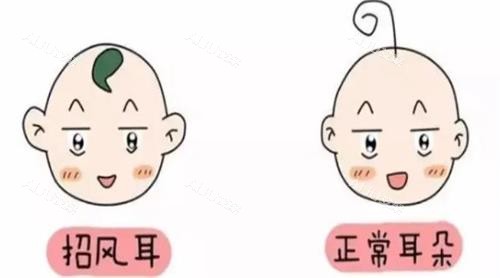 耳朵对比