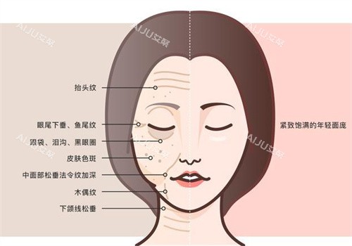 ACT自体有核细胞疗法面部抗衰前后