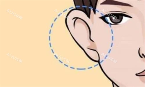 成都陈再洪耳朵矫正 成都陈再洪耳朵矫正