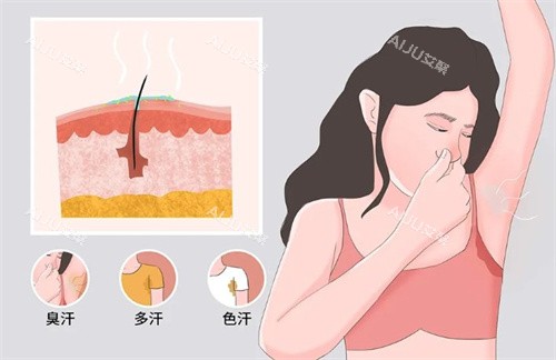 崔玮医生5G激光手术狐臭有哪些症状